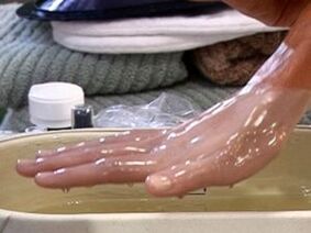 Paraffin therapy for arthrosis